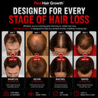 Red Hair Growth Cap - Light Therapy Technology