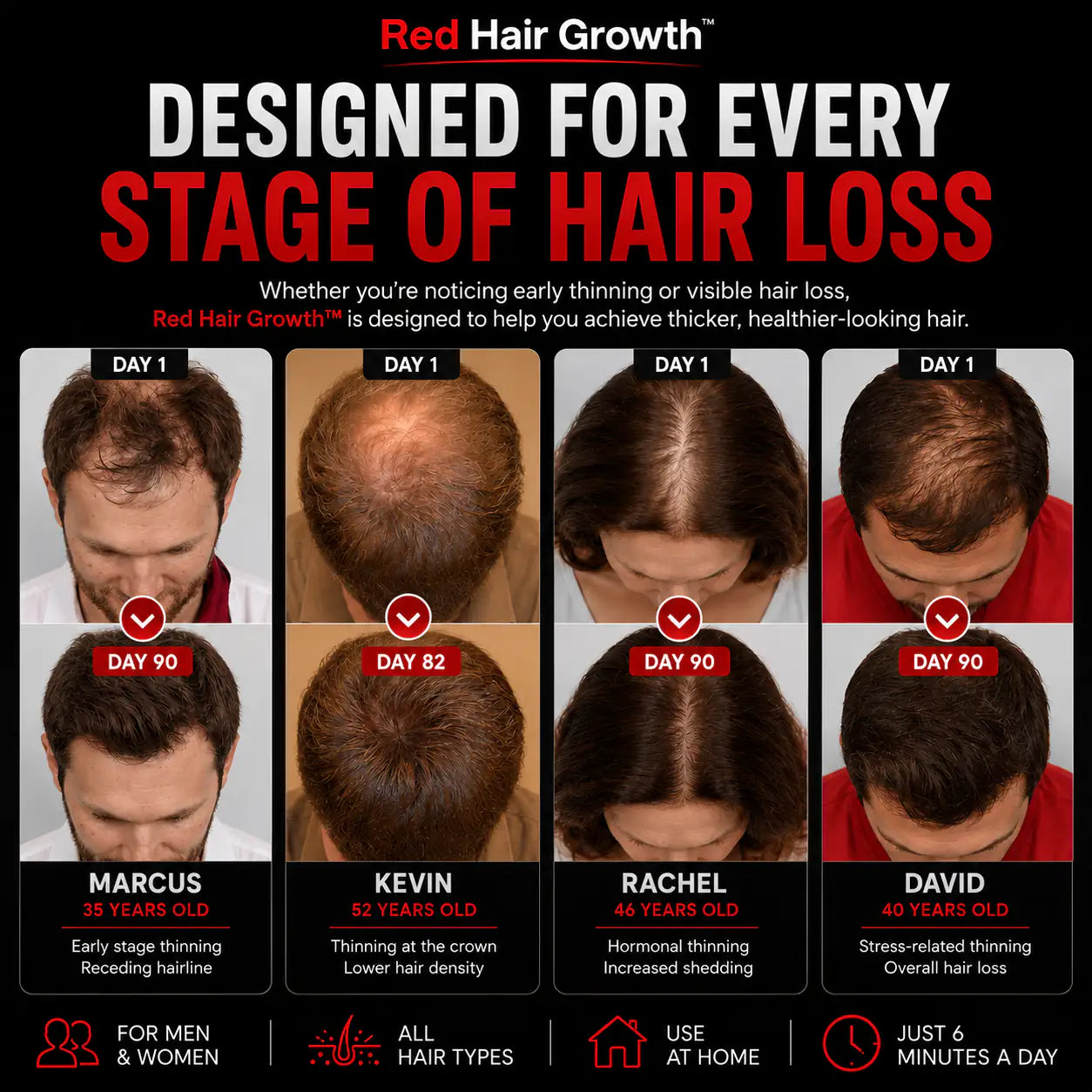 Red Hair Growth Cap - Light Therapy Technology